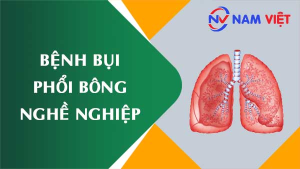 Bệnh bụi phổi bông nghề nghiệp