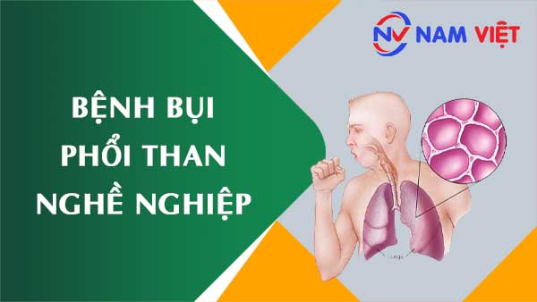 Bệnh bụi phổi than nghề nghiệp