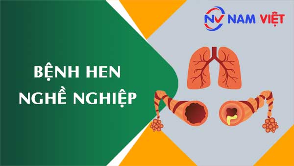 Bệnh hen nghề nghiệp