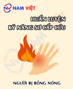 Huấn luyện kỹ năng sơ cấp cứu cho người bị bỏng nóng