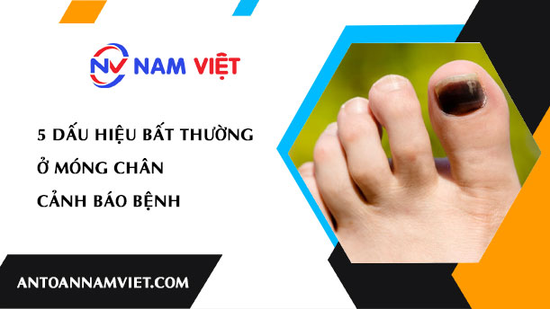 5 DẤU HIỆU BẤT THƯỜNG Ở MÓNG CHÂN CẢNH BÁO BỆNH