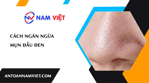 CÁCH NGĂN NGỪA MỤN ĐẦU ĐEN