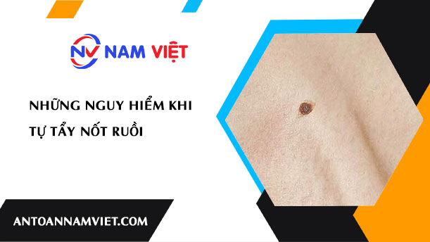 NHỮNG NGUY HIỂM KHI TỰ TẨY NỐT RUỒI
