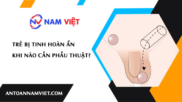 TRẺ BỊ TINH HOÀN ẨN KHI NÀO CẦN PHẪU THUẬT?