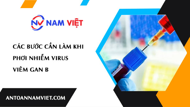 Các bước cần làm khi phơi nhiễm virus viêm gan B