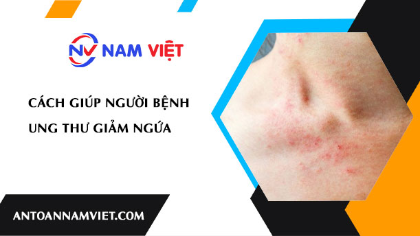 Cách giúp người bệnh ung thư giảm ngứa