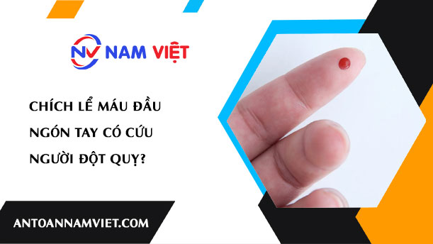 Chích lể máu đầu ngón tay có cứu người đột quỵ?