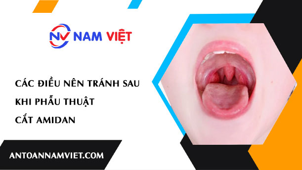 CÁC ĐIỀU NÊN TRÁNH SAU KHI PHẪU THUẬT CẮT AMIDAN