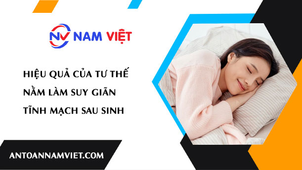 HIỆU QUẢ CỦA TƯ THẾ NẰM LÀM SUY GIÃN TĨNH MẠCH SAU SINH