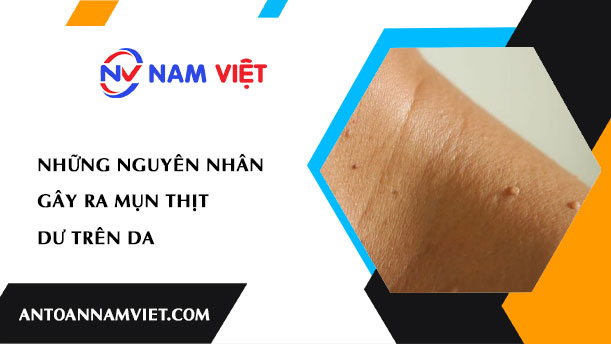 NHỮNG NGUYÊN NHÂN GÂY RA MỤN THỊT DƯ TRÊN DA