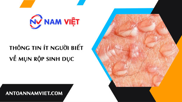 Thông Tin Ít Người Biết Về Mụn Rộp Sinh Dục