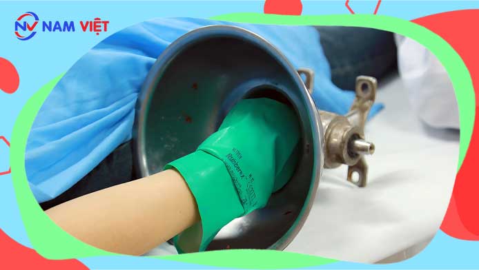 Woman’s hand caught in meat grinder
