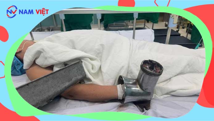 Woman’s hand caught in meat grinder